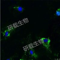 细胞外泌体示踪/染色套餐