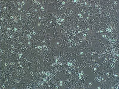 Homo Spaniens cell line Hep B1.2（人肝癌细胞）