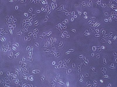 Cell line of lymph Penarus monodon（人淋巴瘤细胞）