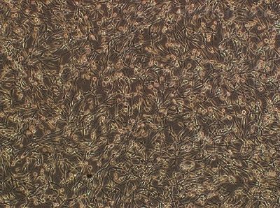 JC-A2939(胃腺癌细胞)