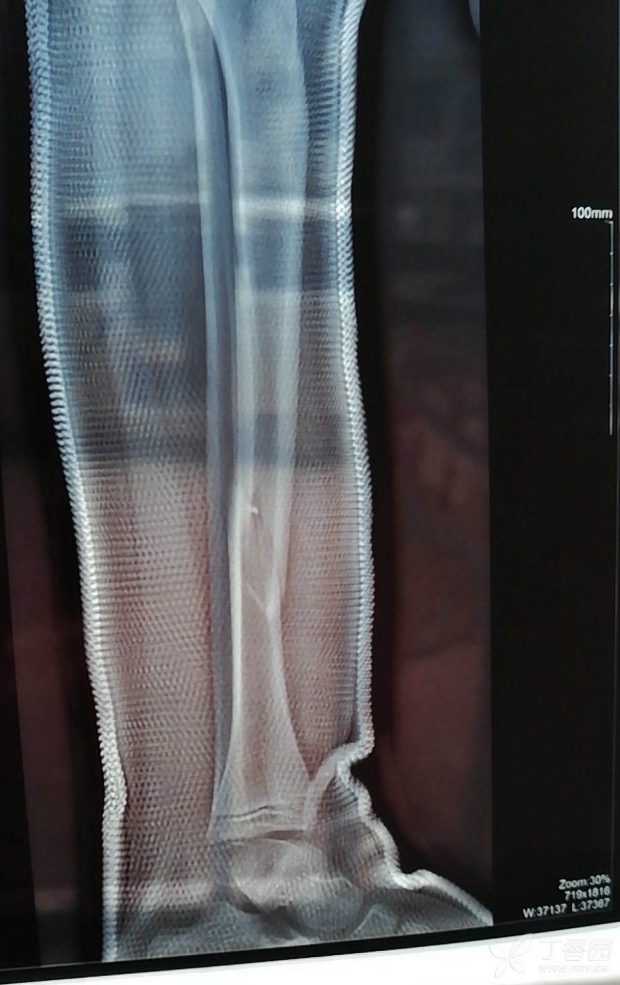 这是第17天拍片