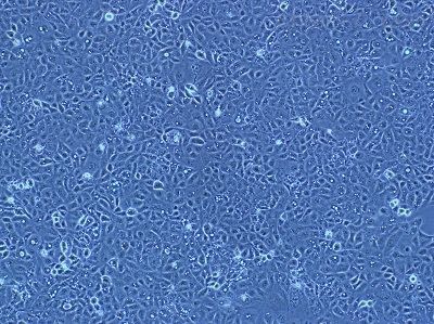 T24人膀胱转行细胞癌细胞