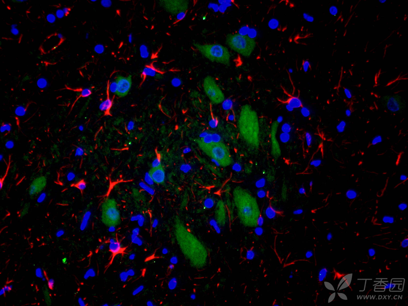 【求助】免疫荧光双标详细实验步骤 - 丁香园论坛