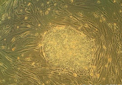 HBMSC 人骨髓间充质干细胞