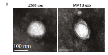 你的外泌体电镜照片，能发表高分文章吗？