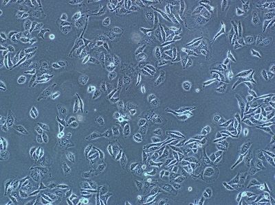 (DCS细胞)小鼠树突状细胞肉瘤细胞