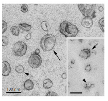 你的外泌体电镜照片，能发表高分文章吗？