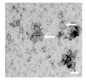 你的外泌体电镜照片，能发表高分文章吗？