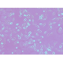 [BeWo细胞]人胎盘绒膜癌细胞