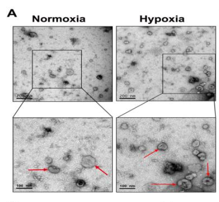 你的外泌体电镜照片，能发表高分文章吗？