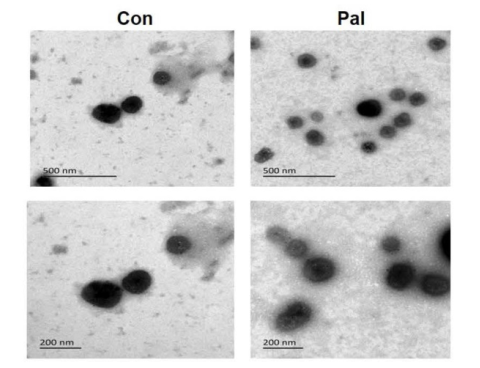 你的外泌体电镜照片，能发表高分文章吗？