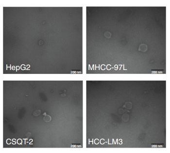 你的外泌体电镜照片，能发表高分文章吗？