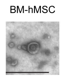 你的外泌体电镜照片，能发表高分文章吗？