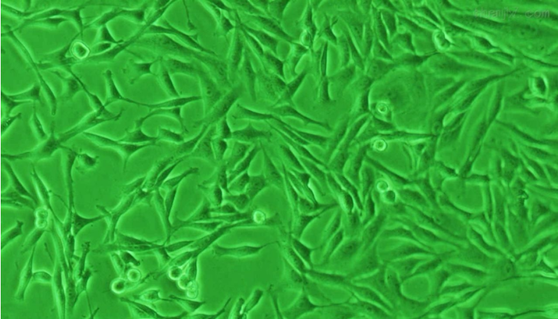 [CCC-HSM-2细胞]人胚胎肌肉组织来源细胞