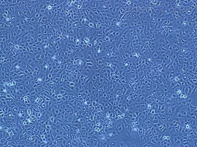 [JAR细胞]人胎盘绒毛癌细胞