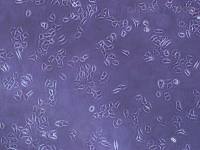 [PG-BE1细胞]人肺巨细胞癌高转移细胞株