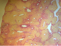 肝纤维化大鼠模型