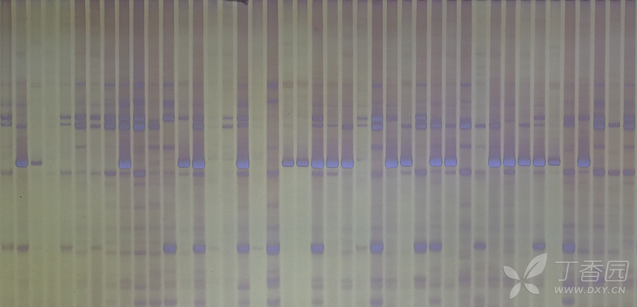 请问一下各位大佬 我在银染过程中,通常情况是下图这种,条带黑白分明