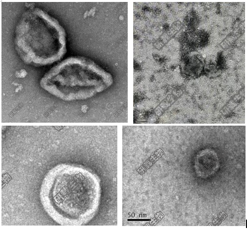 你的外泌体电镜照片，能发表高分文章吗？