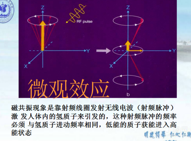 核磁共振的原理是什么_核磁共振原理图解