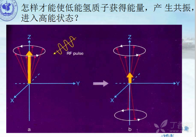 核磁共振的原理是什么_核磁共振原理图解(2)