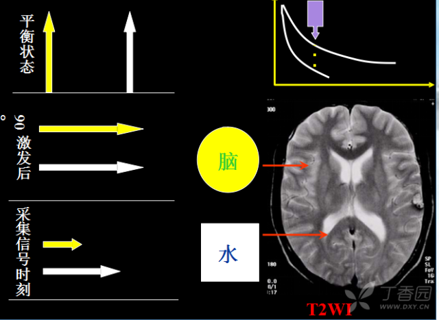 核磁共振的原理是什么_核磁共振原理图解