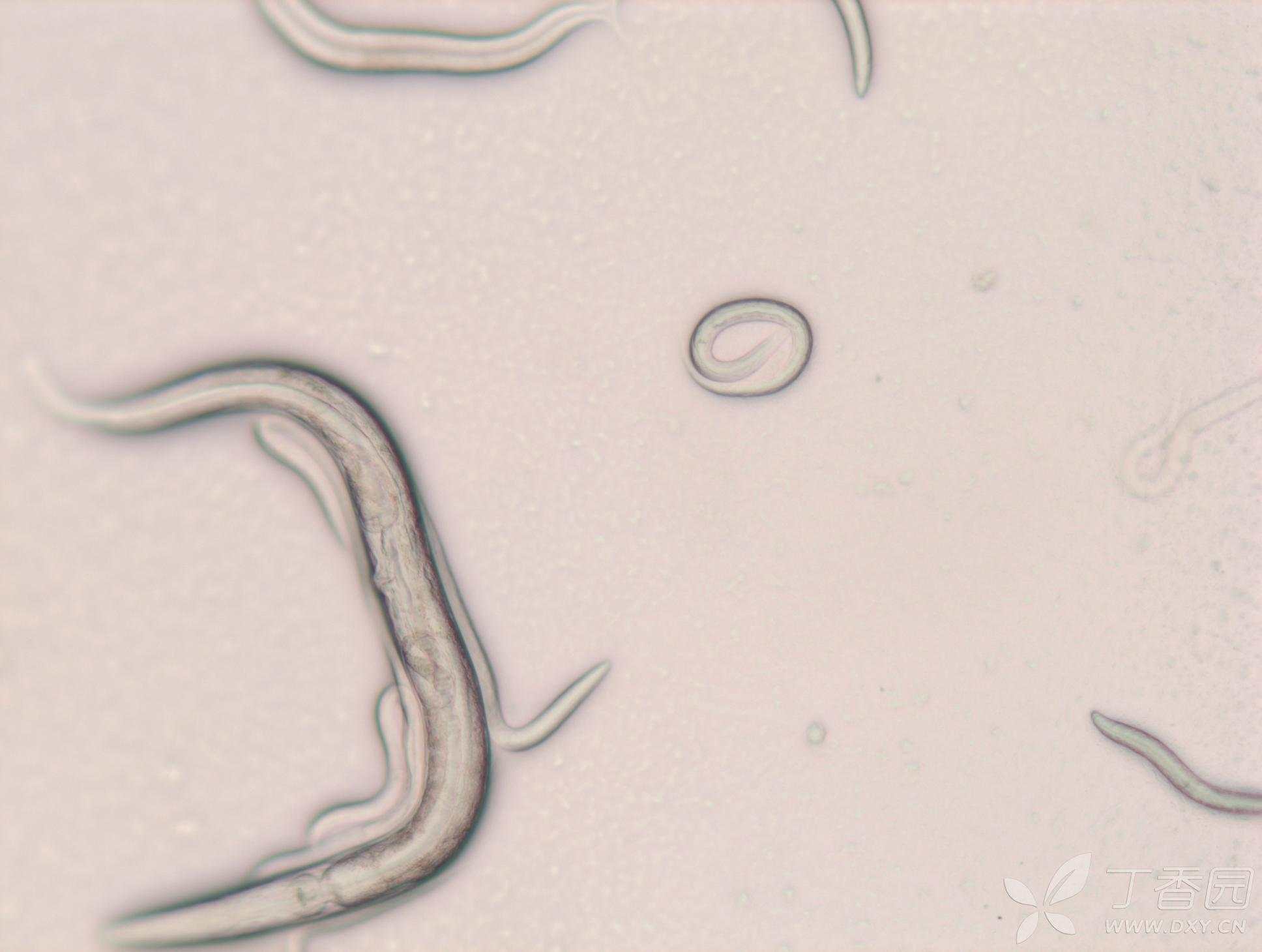 秀丽隐杆线虫的培养和保存