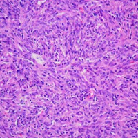 磷钨酸苏木.精染色