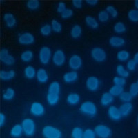 细胞Hochest凋亡染色实验服务