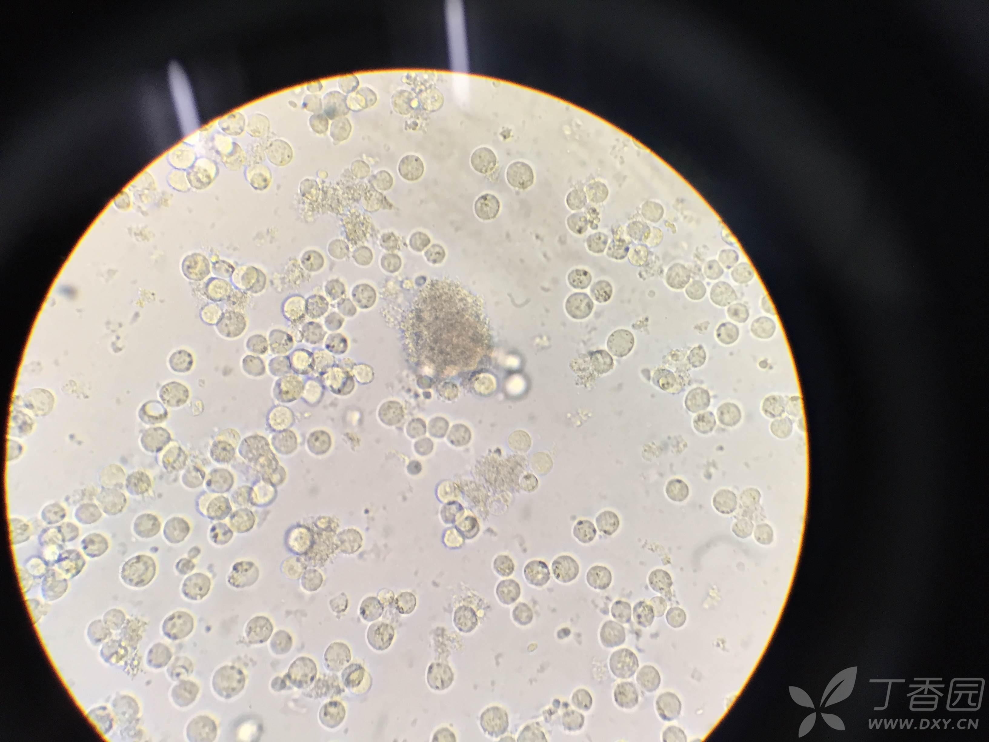 k562细胞培养过程中出现的问题,以及benzidine染色