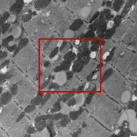 线粒体形态学检测