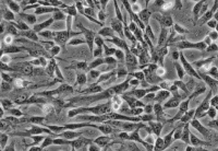 人脐带间充质干细胞