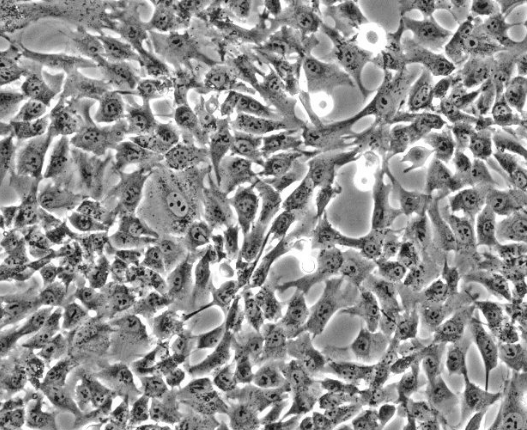 人胎盘羊膜间充质干细胞
