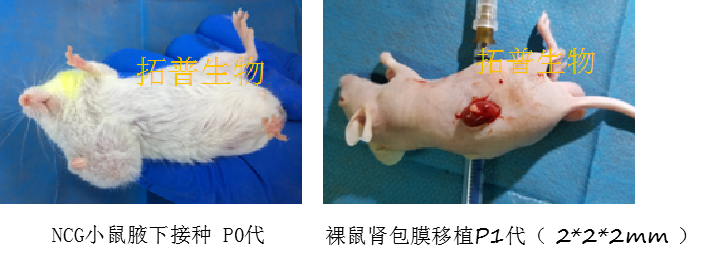 裸鼠成瘤-胃癌细胞SCG-7901