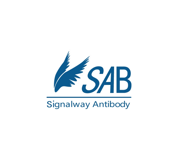 代理：SAB全线产品，欢迎来电咨询（文末附SAB目录表）