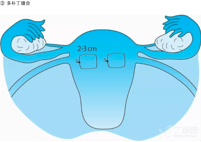 3335155894106697937-8w.png!w640