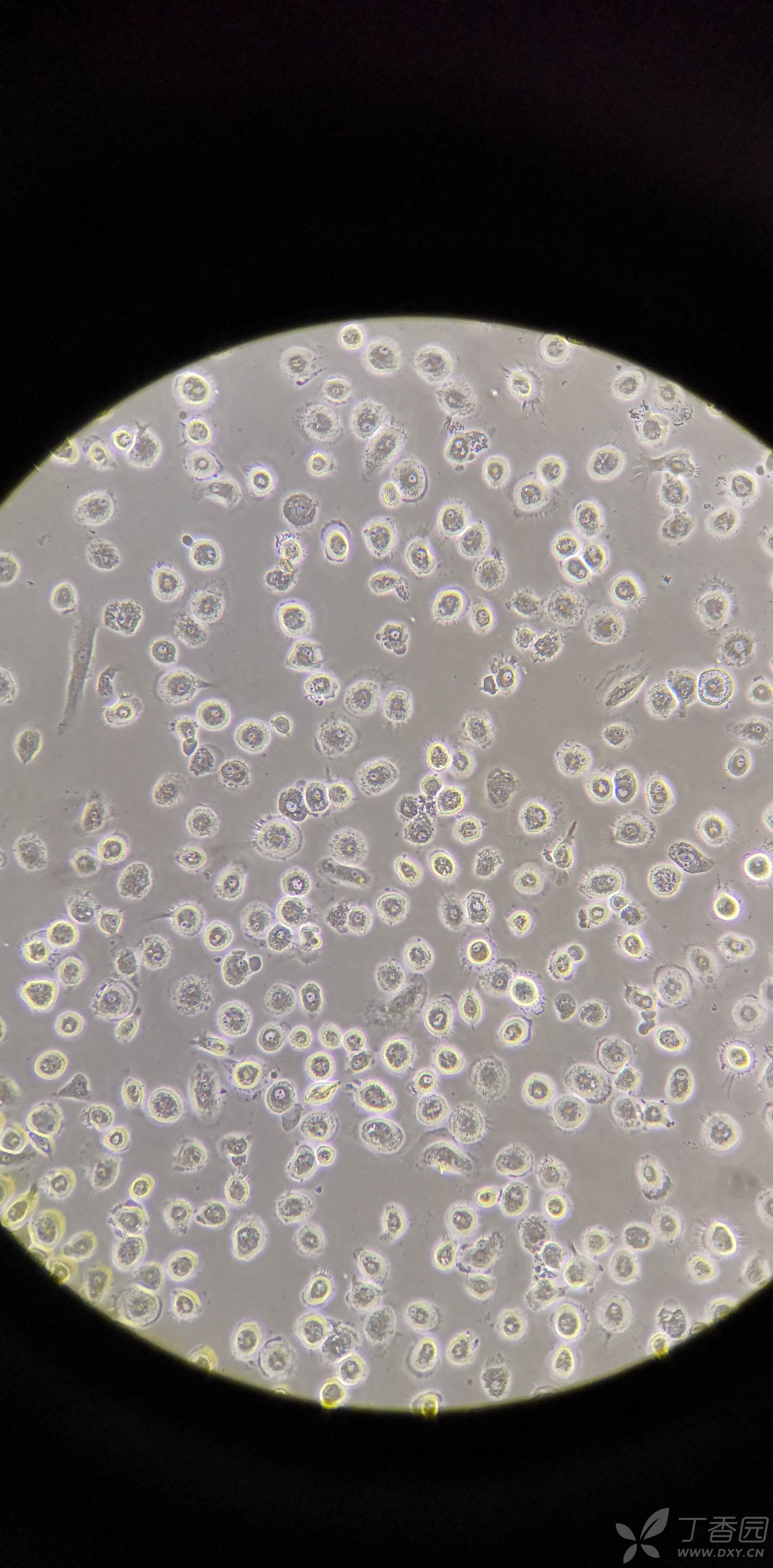 巨噬细胞吞噬癌细胞问题求教
