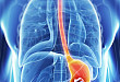 从日本《胃癌处理规约》修订看胃癌治疗发展趋势