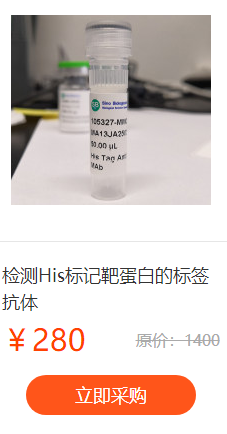 丁香通试剂大联欢之His标签抗体