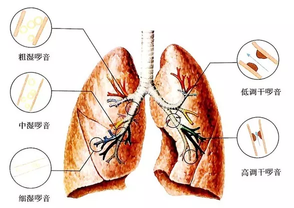 这么多种呼吸音 怎样才能分清楚