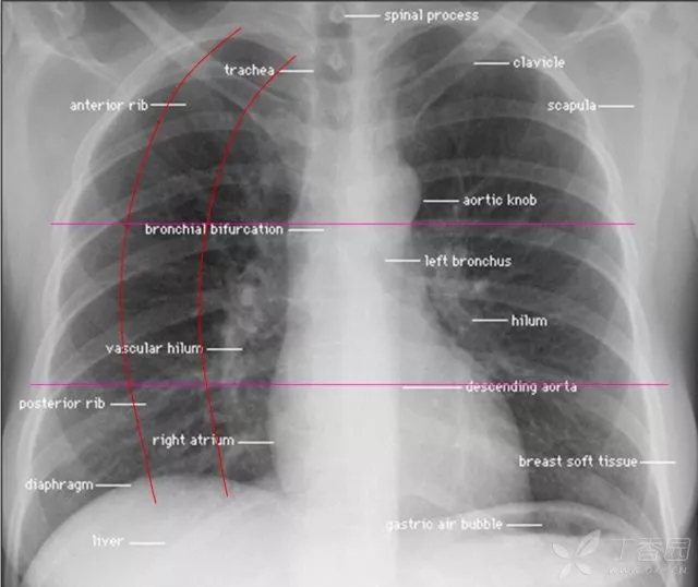 秒懂教学 这下终于会看胸片了