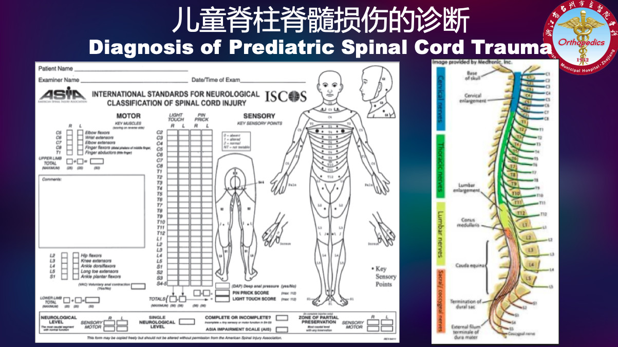 聊聊儿童脊柱脊髓损伤