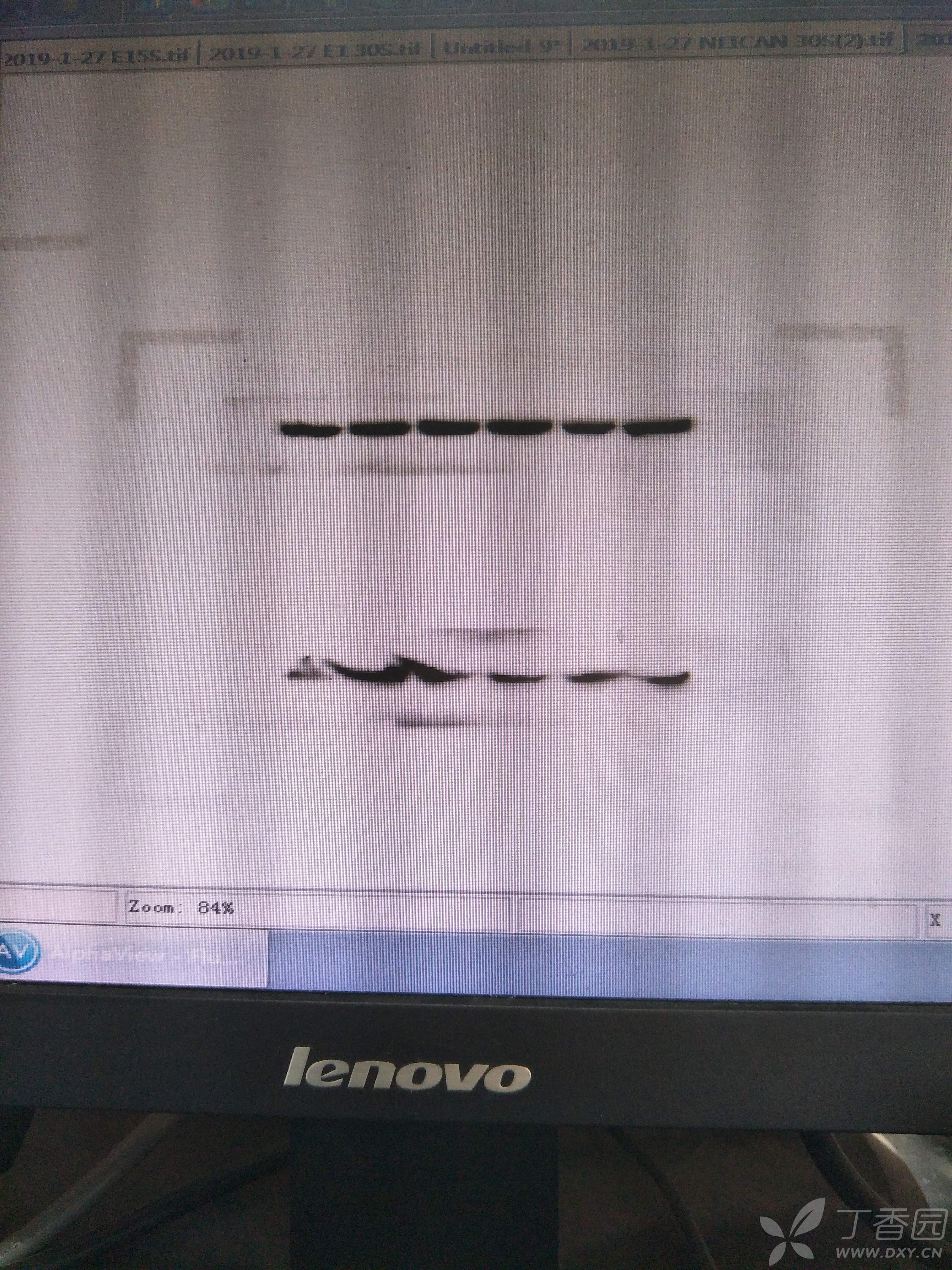 求助:wb湿转后marker变形移位,花了,飘了,散了,目的蛋白显影不佳.