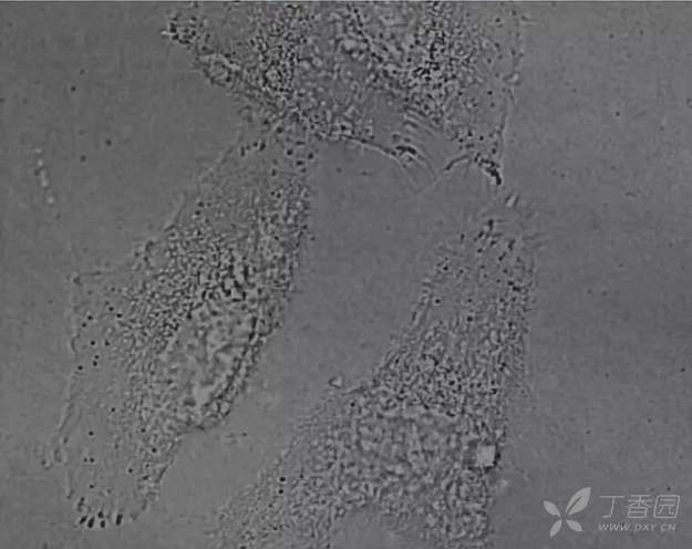 干货|8字法、十字法、螺旋法?细胞铺板方法哪种强?