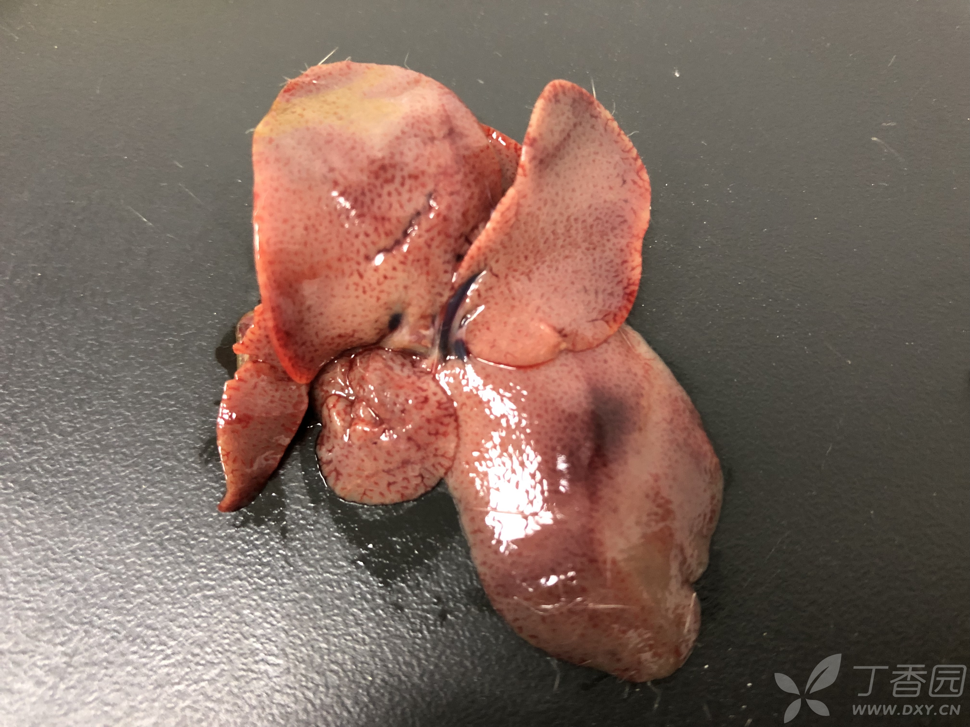 图片,点击后可查看 用硫代乙酰胺连续两天腹腔注射后大鼠肝脏变成这样