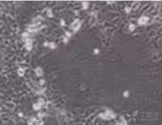 干货|8字法、十字法、螺旋法?细胞铺板方法哪种强?