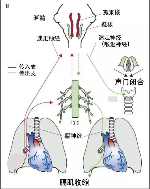 心梗「奇葩」表现,总有你没见过的!