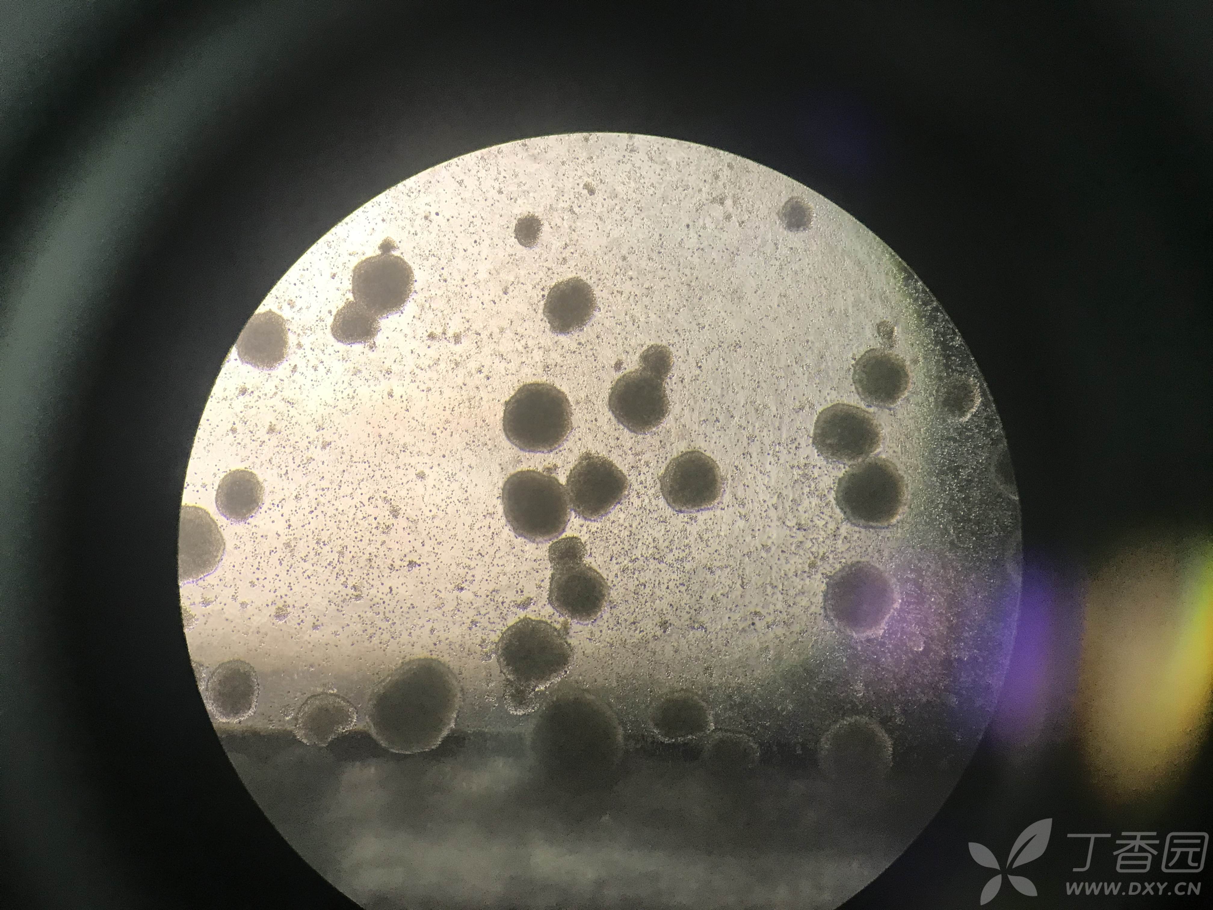 永生化b淋巴细胞的培养过程中细胞不聚团