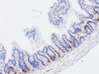Tunel细胞凋亡检测