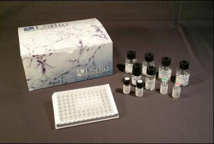 Human PAI-1 + tPA Complex ELISA Kit (Sandwich ELISA) - LS-F10422